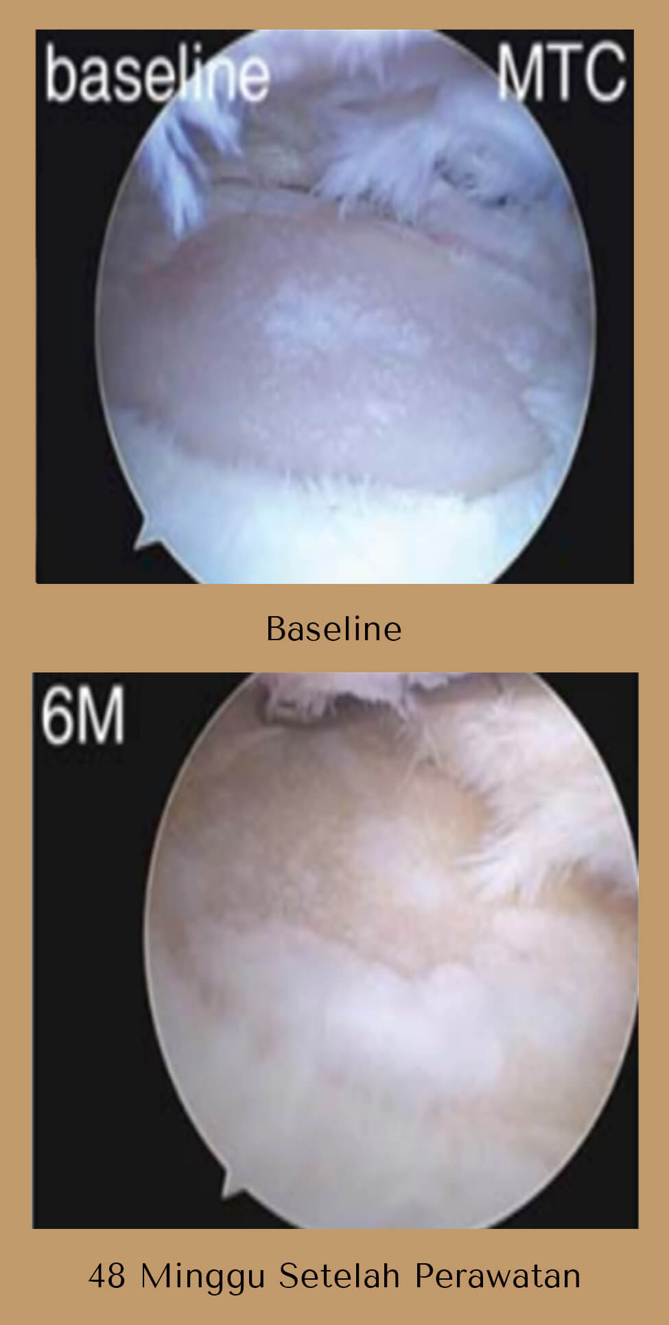 RPR-1 copy 2