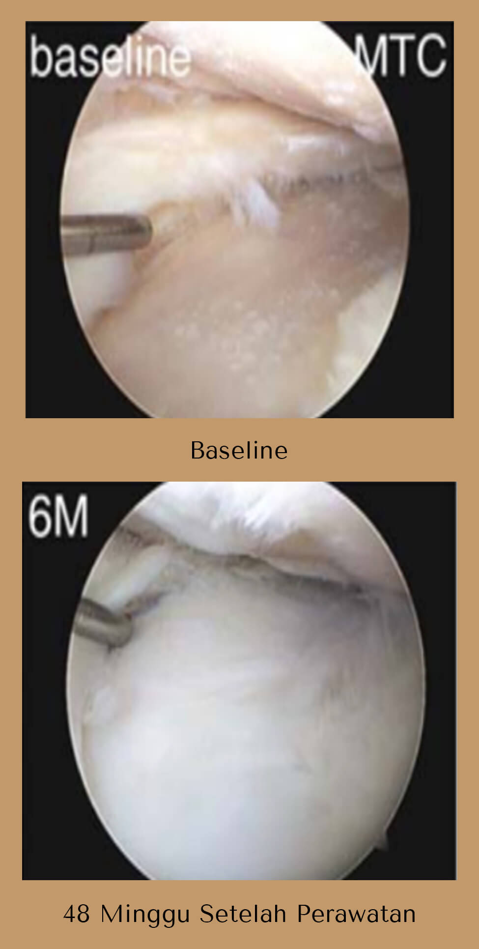 RPR-1 copy 3